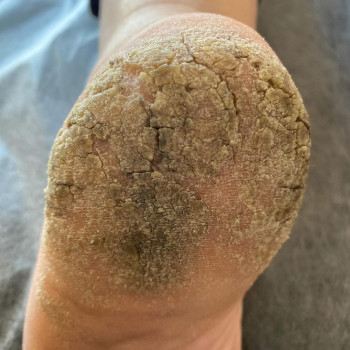 Фото с портфолио Ольга Живець