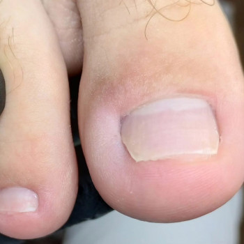 Динаміка ПІСЛЯ/