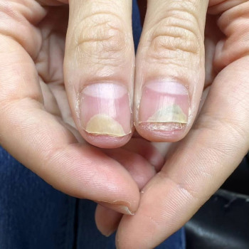 Фото с портфолио Ольга Живець