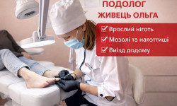 Диагностика стопы Подолог Ольга Чернигов