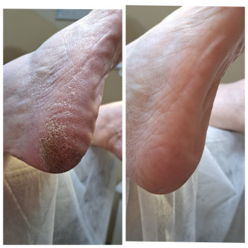 Фото с портфолио Оксана Коваленко