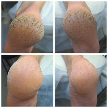 Фото с портфолио Оксана Коваленко