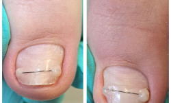 Установка коррекционных систем Подолог Оксана Харьков