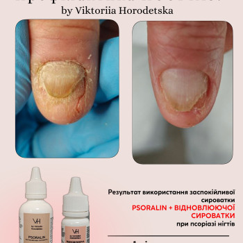 Фото с портфолио Вікторія Городецька