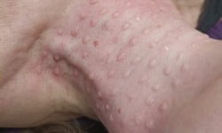 Биоревитализация Косметолог-естетист Светлана Дніпро