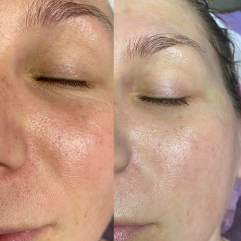 Фото с портфолио Катерина Сіліна