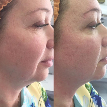 Фото с портфолио Олена Денисова