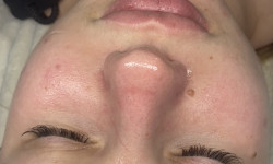 Преміум чистка обличчя від CEF LAB Косметолог-эстетист Катерина Николаев