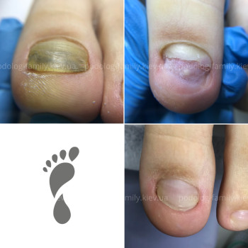 Фото с портфолио Катерина Олександрівна Олійник