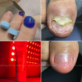 Фото с портфолио Катерина Олександрівна Олійник