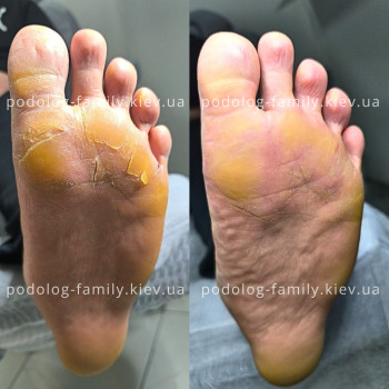 Фото с портфолио Катерина Олександрівна Олійник