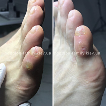 Фото с портфолио Катерина Олександрівна Олійник