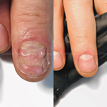 Фото с портфолио Катерина Олександрівна Олійник