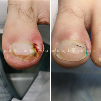 Фото с портфолио Катерина Олександрівна Олійник