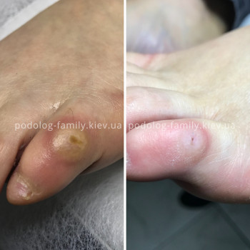 Фото с портфолио Катерина Олександрівна Олійник