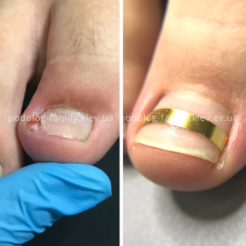 Фото с портфолио Катерина Олександрівна Олійник