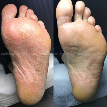 Фото с портфолио Катерина Олександрівна Олійник