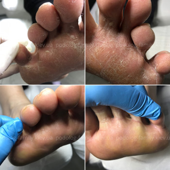 Фото с портфолио Катерина Олександрівна Олійник