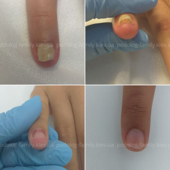 Фото с портфолио Катерина Олександрівна Олійник