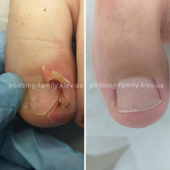 Фото с портфолио Катерина Олександрівна Олійник