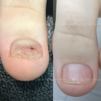 Фото с портфолио Катерина Олександрівна Олійник