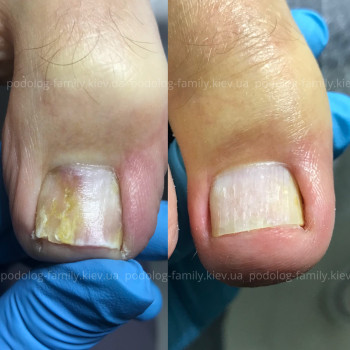 Фото с портфолио Катерина Олександрівна Олійник