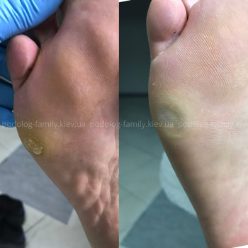 Фото с портфолио Катерина Олександрівна Олійник