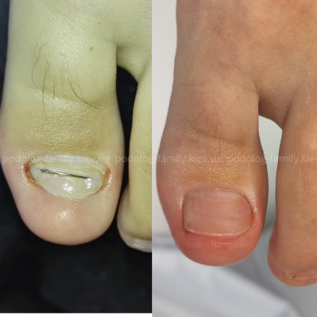 Фото с портфолио Катерина Олександрівна Олійник