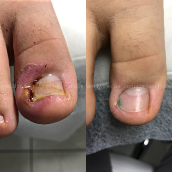 Фото с портфолио Катерина Олександрівна Олійник