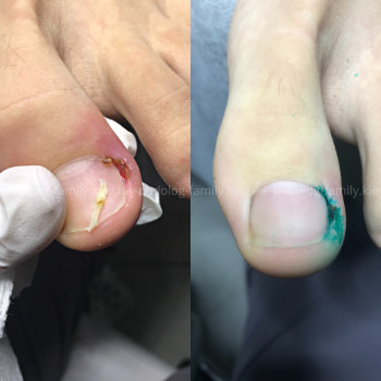 Фото с портфолио Катерина Олександрівна Олійник