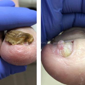 Фото с портфолио Катерина Олександрівна Олійник