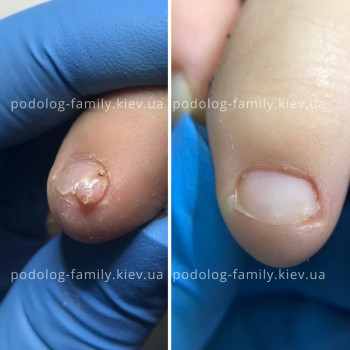 Фото с портфолио Катерина Олександрівна Олійник