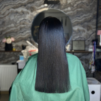 Мікропротезування волосся