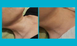 Экзосомы Косметолог-эстетист Ирина Валерьевна Одесса