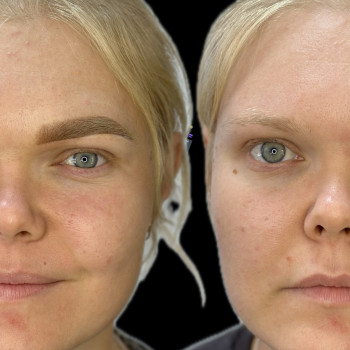 Фото с портфолио Ольга Чикалова