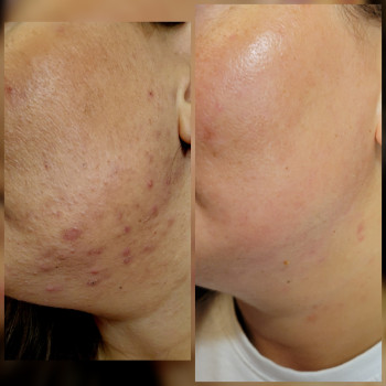 Фото с портфолио Анна Довгополая