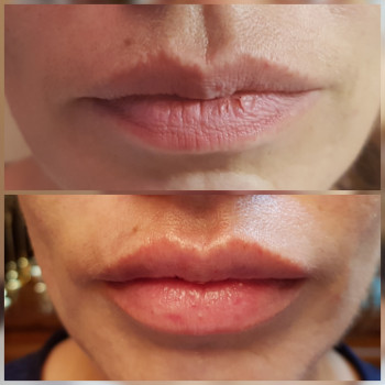 Фото с портфолио Анна Довгополая