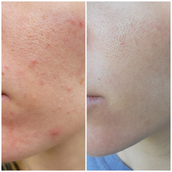 Фото с портфолио Анна Довгополая