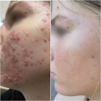 Фото с портфолио Анна Довгополая