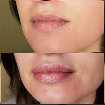 Фото с портфолио Анна Довгопола