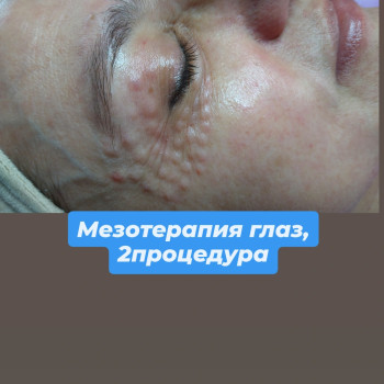 Фото с портфолио Людмила Коренко