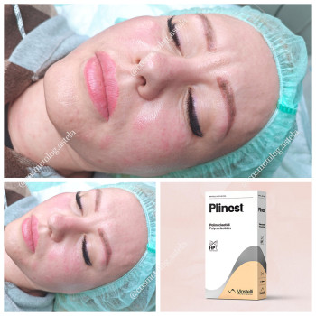 Полінуклеотиди