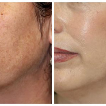 Фото с портфолио Мария Ли