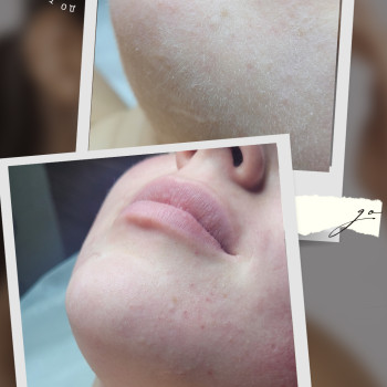 Гладкість обличчя ніхто не відміняв)) Це той випадок, коли сонечко не підведе тебе😉