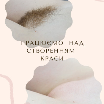 Гарне "ДО" та "після" , правда))