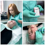 Уколи молодості! Біоревіталізація - 30 % Косметолог Анна Винница