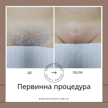 Фото с портфолио Катерина Кукобко