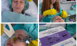 Ультразвукова чистка обличчя (+ сироватка +маска в подарунок) Косметолог Анна Винница