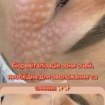 Фото с портфолио Наталья Грицай