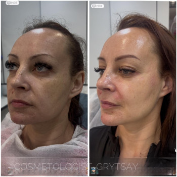 Фото с портфолио Наталья Грицай